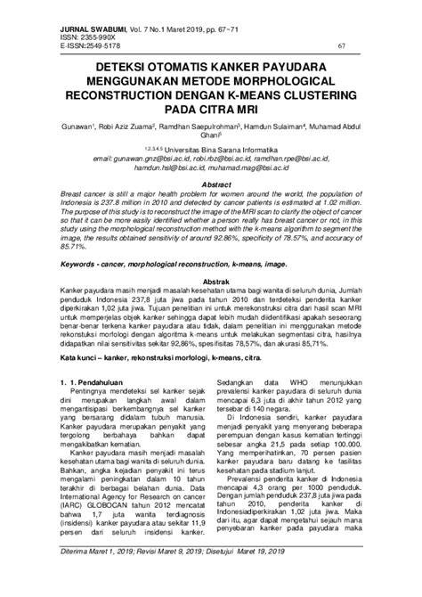 Brazzer Payudara Indikator transpose otomatis yang Praktis image 4