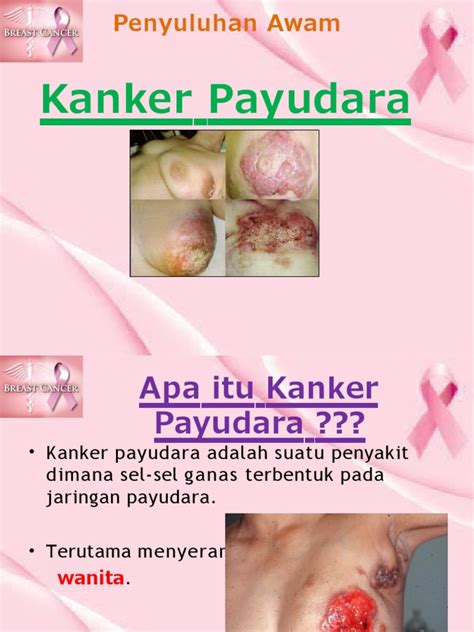 pOrn TerbarU tentang payudara besar dan login akun baru 301 pilihan image 1